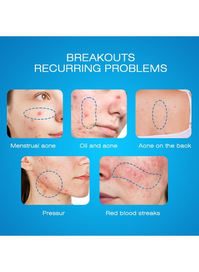 Sumifun 4% Acne Scar Fading Cream - 4% Complex Fading Factor, Suitable for All Skin Types, Reduces Acne Scars and Pits, Deeply Penetrates, 20g - Image 5